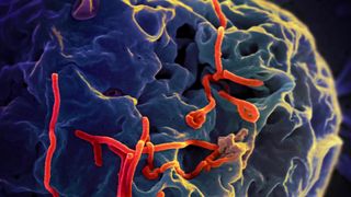 Zoonotic Diseases in the Global South Merit Our Attention Too (Columns)