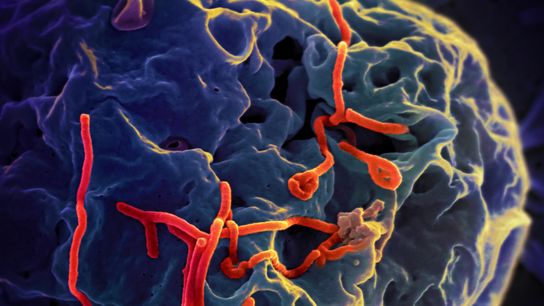 Zoonotic Diseases in the Global South Merit Our Attention Too (Columns)